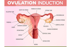 MALE INFERTILITY